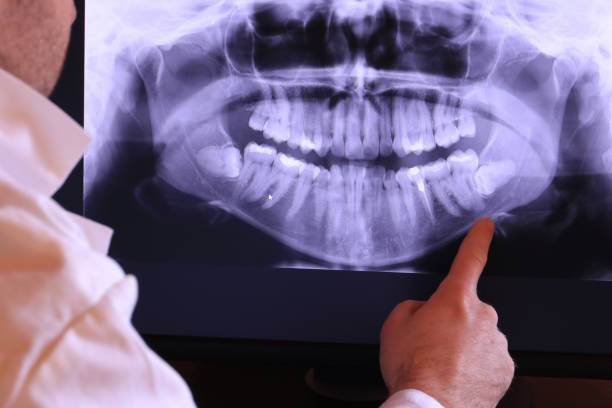 Best Emergency Treatment for Dental Infections or Abscesses in Kaibab Estates West, AZ